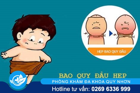 Hẹp bao quy đầu có nhất thiết phải cắt?