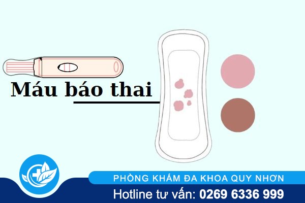 Nhận diện máu báo thai chính xác nhất