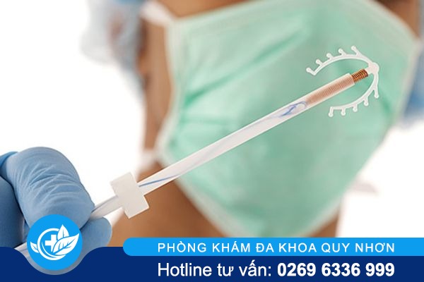 Tháo vòng tránh thai có đau không và ở đâu an toàn?