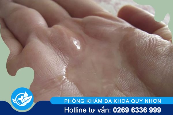 Tinh trùng loãng có con được không? 