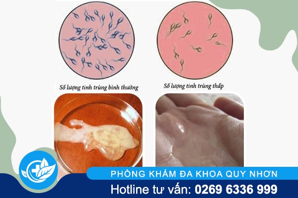 tinh-trung-loang-co-con-duoc-khong-1