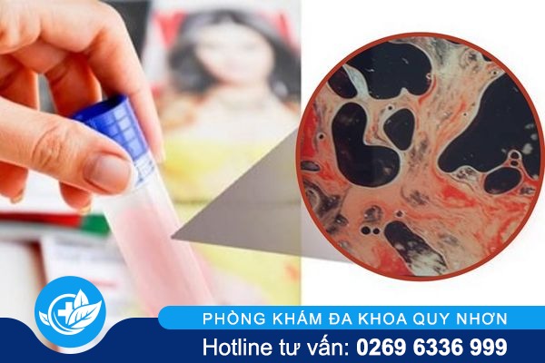 xuat-tinh-ra-mau-la-do-dau-va-dieu-tri-nhu-the-nao-hieu-qua-1