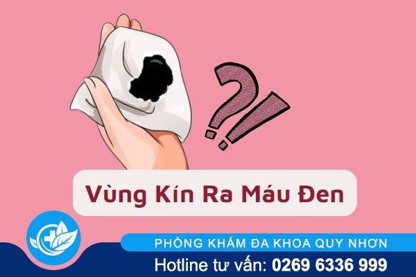 Vùng kín ra máu đen cảnh báo điều gì và phải làm sao?