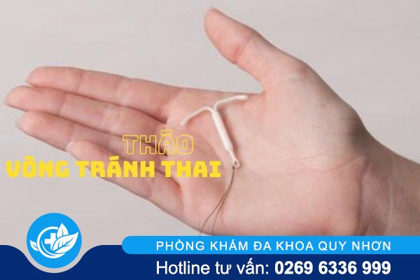Khi tháo vòng tránh thai cần lưu ý điều gì?