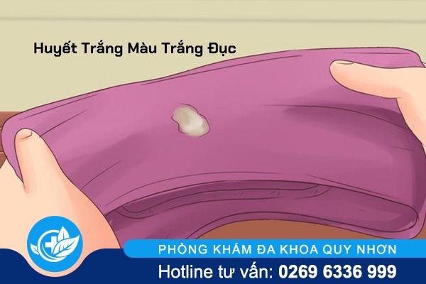 Lý do gây huyết trắng màu trắng đục và cách giải quyết