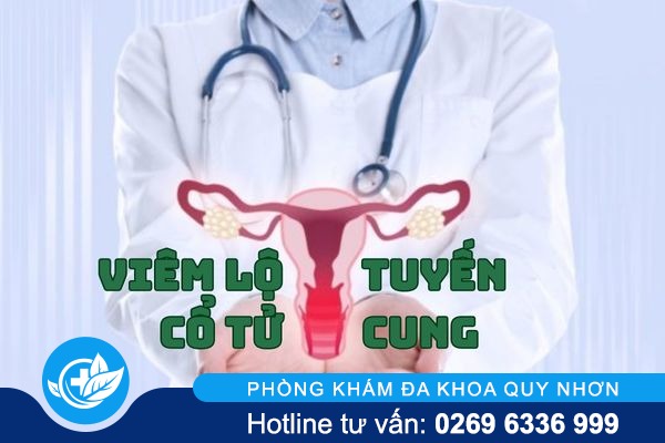 Thông tin cần biết về bệnh viêm lộ tuyến cổ tử cung