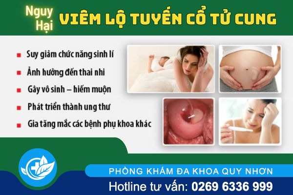 thong-tin-can-biet-ve-benh-viem-lo-tuyen-co-tu-cung-4