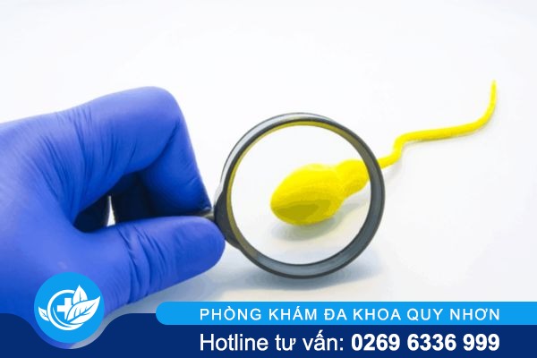 Tinh dịch có màu khác thường cảnh báo điều gì?