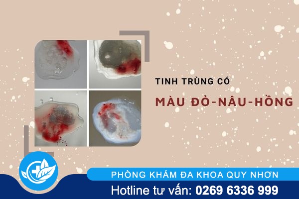 tinh-dich-co-mau-khac-thuong-canh-bao-dieu-gi-4