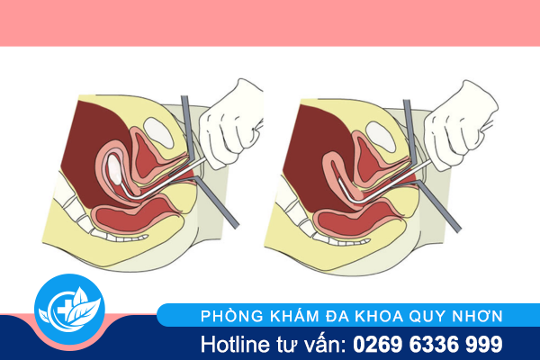 cach-nao-pha-thai-1-tuan-an-toan-va-chi-phi-ra-sao-3