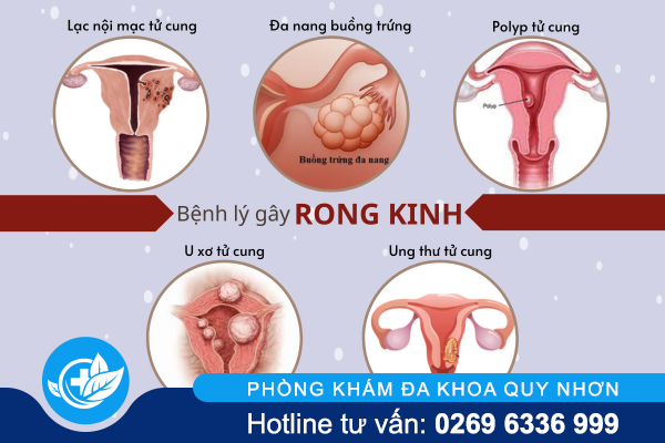 chua-benh-rong-kinh-nhu-the-nao-hieu-qua-2