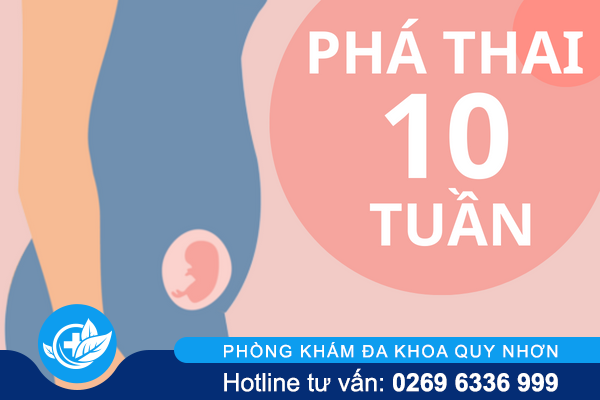 Có nên tiến hành phá thai 10 tuần?