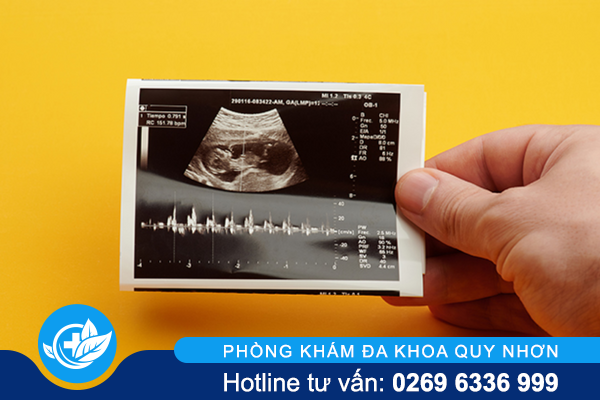 co-nen-tien-hanh-pha-thai-10-tuan-1