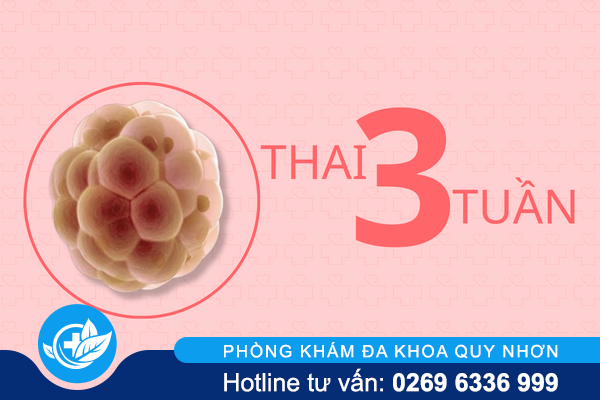 dieu-can-luu-y-khi-quyet-dinh-pha-thai-3-tuan-1
