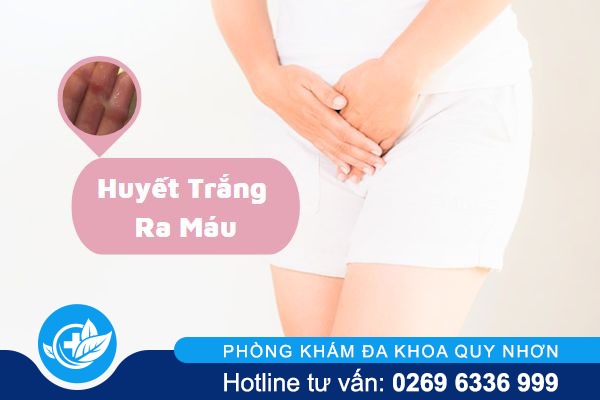 Huyết trắng ra máu cảnh báo điều gì?
