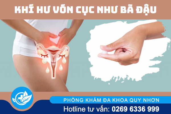 Khí hư vón cục như bã đậu là bị gì?