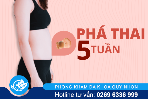 Những vấn đề nên biết khi phá thai 5 tuần