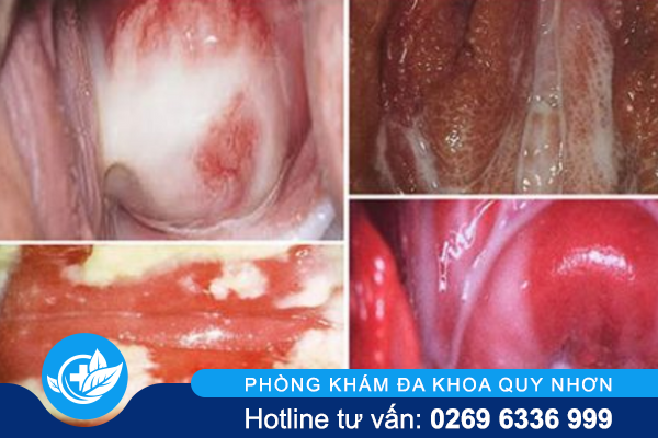 quan-he-ra-mau-nu-la-do-dau-va-lam-sao-khac-phuc-2