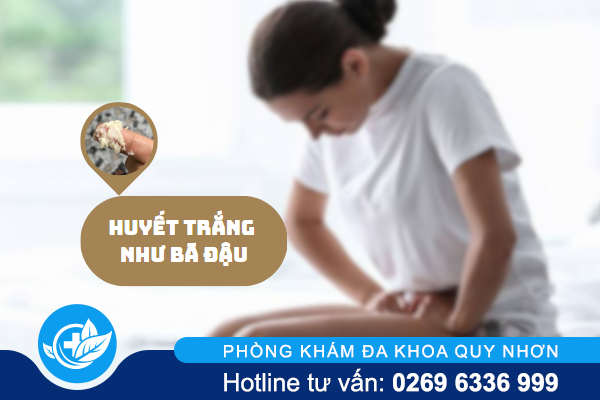 Tại sao gặp phải huyết trắng như bã đậu?