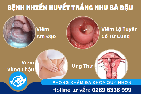 tai-sao-gap-phai-huyet-trang-nhu-ba-dau-1