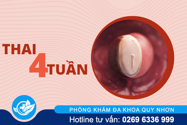 thuc-hien-pha-thai-4-tuan-an-toan-nhu-the-nao-1