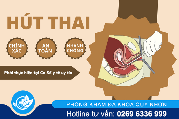 thuc-hien-pha-thai-6-tuan-duoc-khong-3