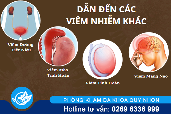 benh-mun-rop-nam-la-gi-va-chua-tri-ra-sao-3