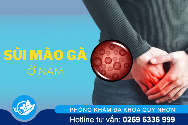 Cảnh báo bệnh sùi mào gà ở nam giới