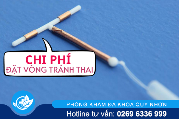 Chi phí đặt vòng tránh thai là bao nhiêu?