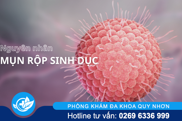 Điểm danh các nguyên nhân mụn rộp sinh dục