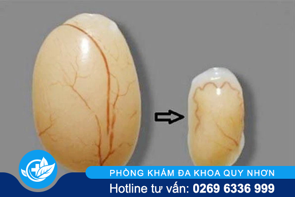 duong-vat-nho-la-do-dau-va-cach-nao-cai-thien-2