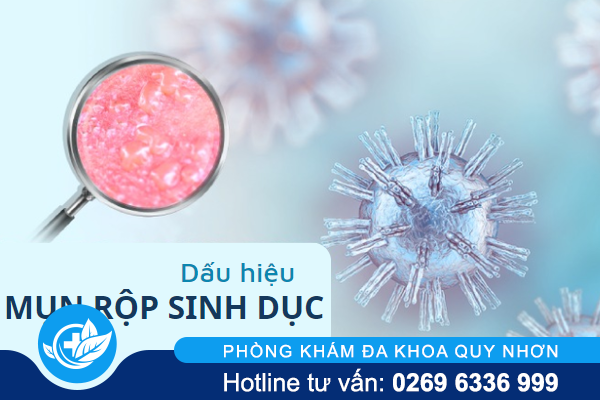 Nhận biết dấu hiệu mụn rộp sinh dục