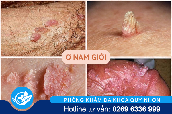 nhan-biet-dau-hieu-sui-mao-ga-bieu-hien-tren-co-the-2