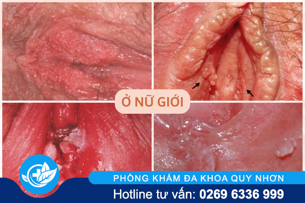 nhan-biet-dau-hieu-sui-mao-ga-bieu-hien-tren-co-the-3