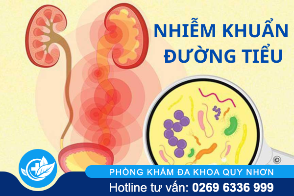 Nhiễm khuẩn đường tiểu là gì và điều trị ra sao?