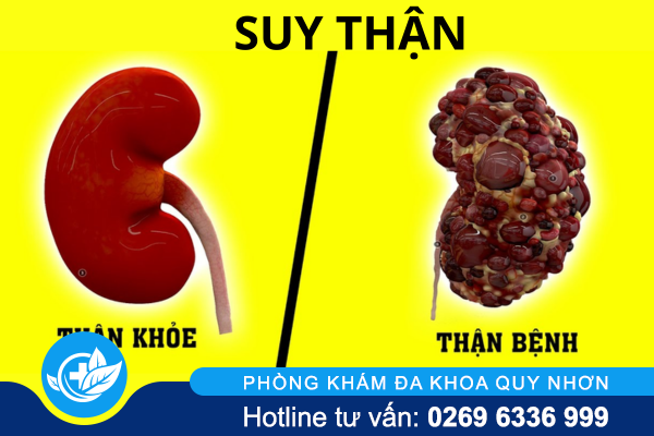 nhiem-khuan-duong-tieu-la-gi-va-dieu-tri-ra-sao-2