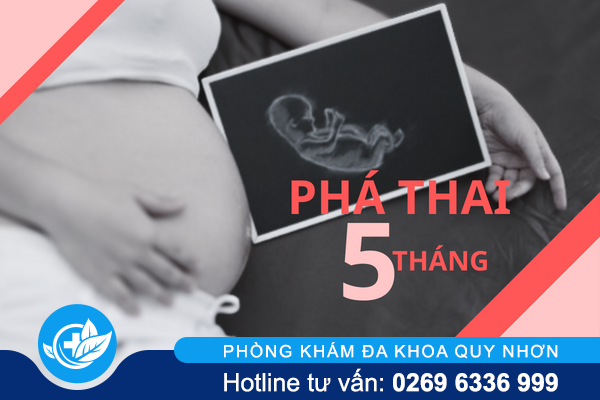 Những điều cần lưu ý khi phá thai 5 tháng