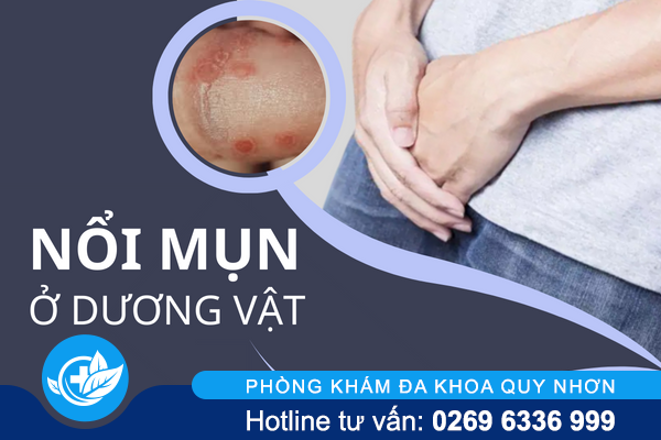 Nổi mụn ở dương vật là bị gì?