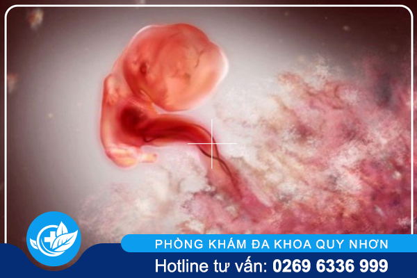 pha-thai-1-thang-duoc-khong-va-bang-cach-nao-1