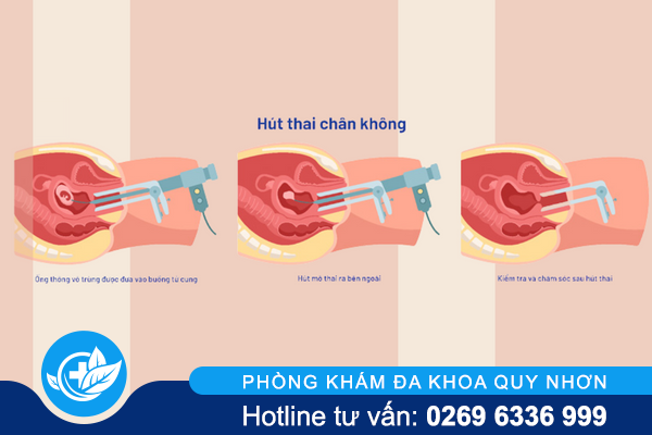 pha-thai-2-thang-co-duoc-khong-cach-nao-an-toan-2