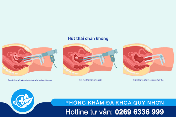 pha-thai-3-thang-con-an-toan-khong-2