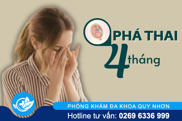 Phá thai 4 tháng có đủ an toàn không?