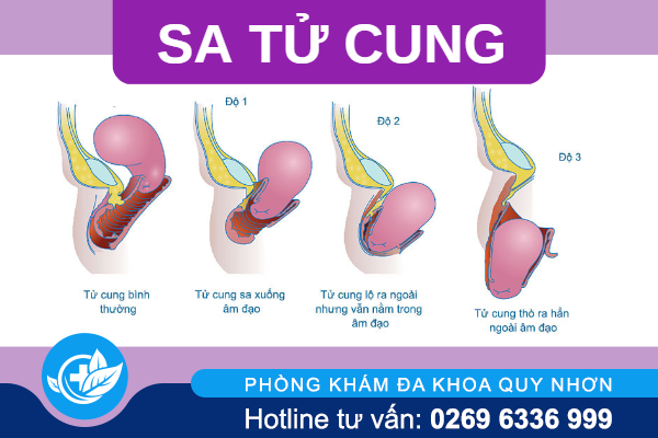 sa-tu-cung-va-nhung-thong-tin-dung-bo-qua-1