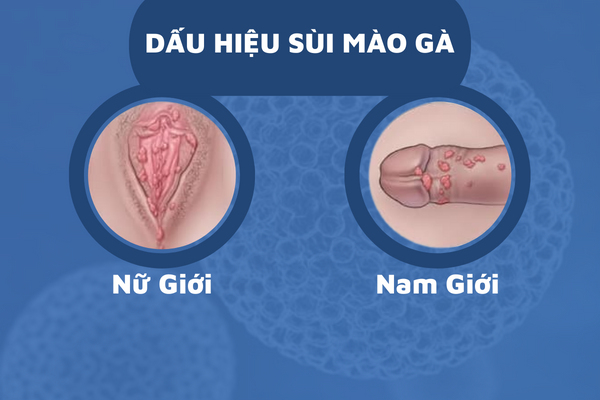 sui-mao-ga-su-nguy-hiem-dang-sau-mun-sui-3