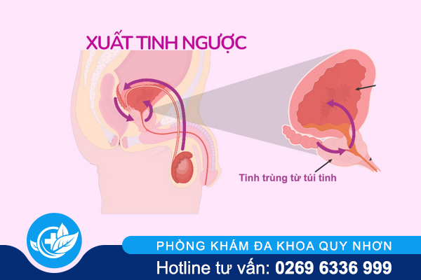 tai-sao-quan-he-khong-xuat-tinh-va-khac-phuc-the-nao-2