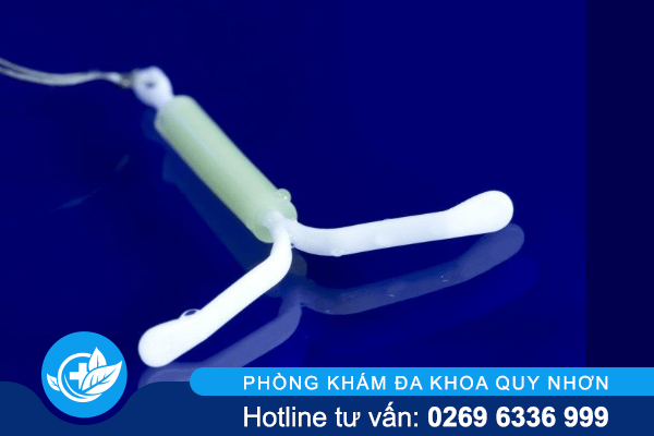 Thay vòng tránh thai cần lưu ý điều gì?