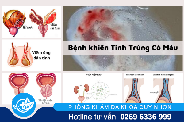 tinh-trung-co-mau-dau-hieu-khong-the-xem-thuong-1