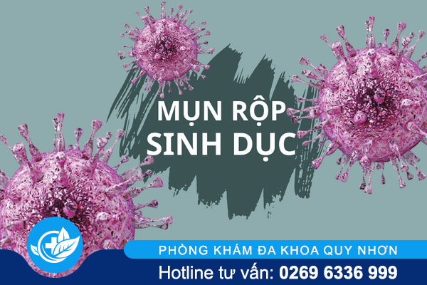 Tổng hợp thông tin hữu ích về mụn rộp sinh dục