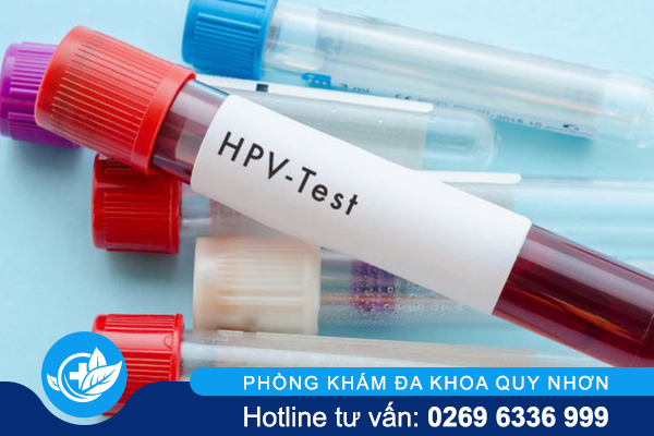 Xét nghiệm HPV như thế nào và ở đâu chính xác?