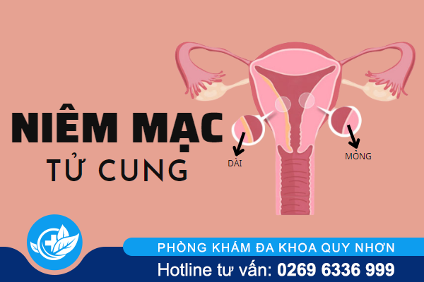 Hiểu đúng về niêm mạc tử cung và bệnh lý thường gặp